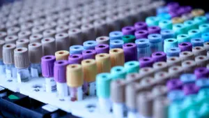 Plusieurs tubes de prélèvement sanguin prêts pour des analyses en laboratoire médical.